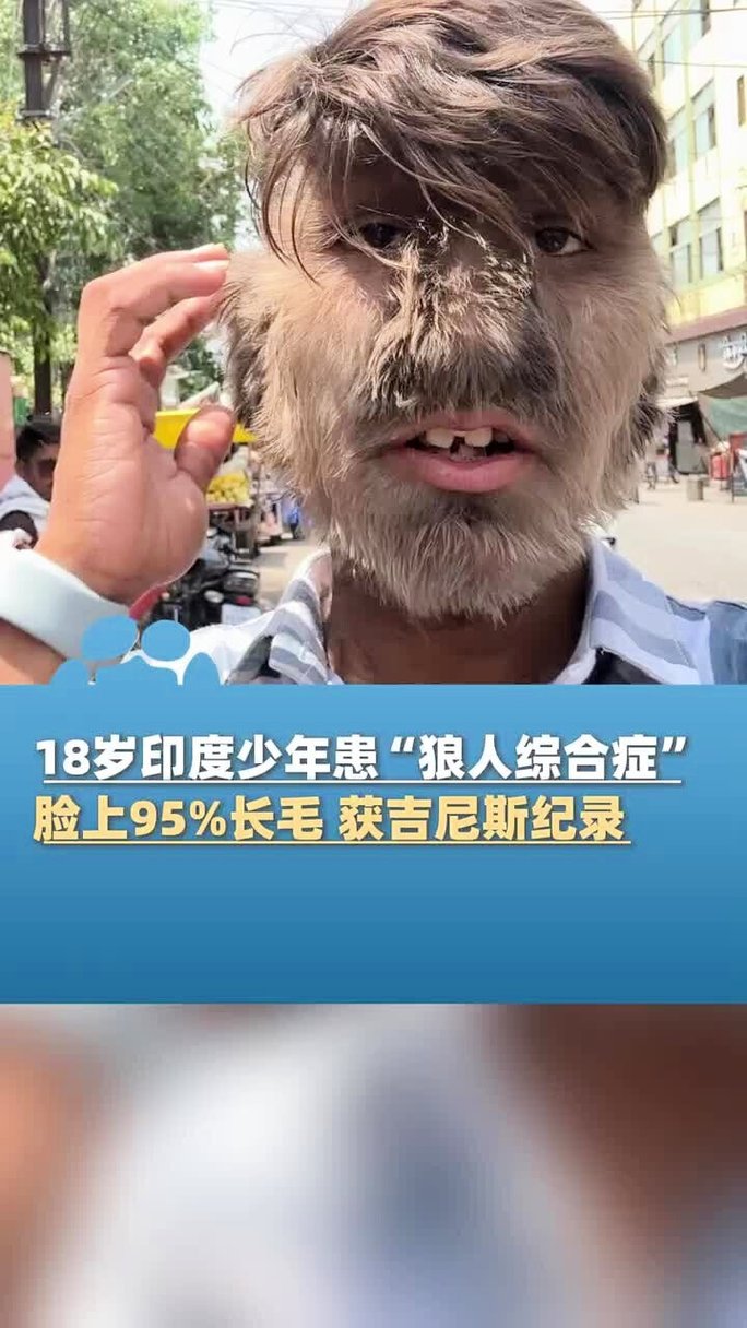 人妻熟女少妇免费看的相关介绍